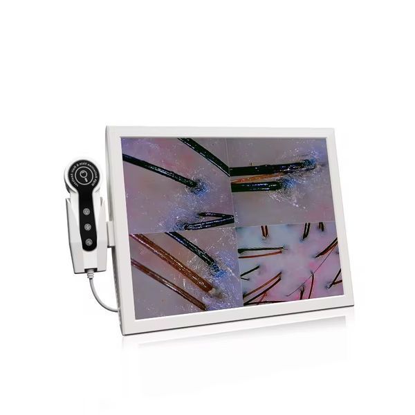Трихоскоп Premium Plus 50/200x KX_trihoskop_premium_plus фото