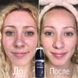 Пенка для умывания и сужения пор Pore Fill Up Chorcoal Bubble Cleanser RS_11030100 фото 3